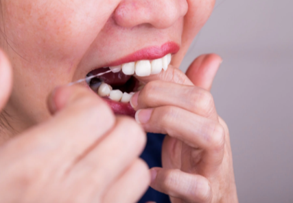 Flossing: A Cornerstone of Dental Hygiene