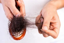 Hair Loss