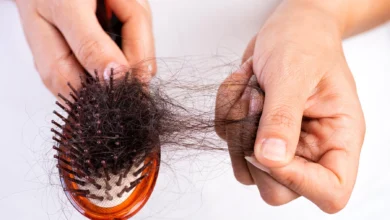 Hair Loss