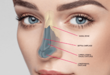 Rhinoplasty: Transform Your Look with Expert Care from Dr. Shahidi