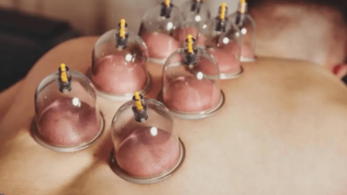 Discover the Healing Benefits of Hijama in Sydney at Alchemist Remedial Clinic
