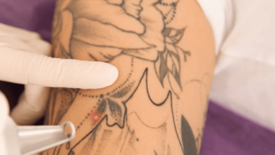 Mastering the Art of Tattoo Removal Training: Your Pathway to Expertise